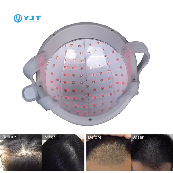 Lllt 650nm Laser Diode Hair Growth Cap for Hair Loss Treatment